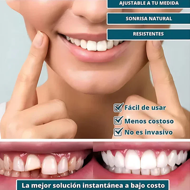 [PAGA 1 y LLEVA 2]SmilePro 🦷 - Carillas Dentales Ajustables De Resina + ESTUCHE REGALO - ¡Últimas unidades!