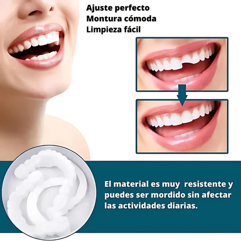 [PAGA 1 y LLEVA 2]SmilePro 🦷 - Carillas Dentales Ajustables De Resina + ESTUCHE REGALO - ¡Últimas unidades!