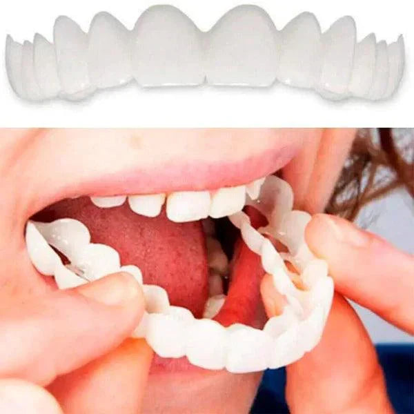 [PAGA 1 y LLEVA 2]SmilePro 🦷 - Carillas Dentales Ajustables De Resina + ESTUCHE REGALO - ¡Últimas unidades!